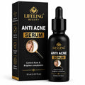 Lifeling Beauty Anti Acne Serum, Controls Oil & Shine, Brightens Complexion, Fights Breakouts, 30 ml