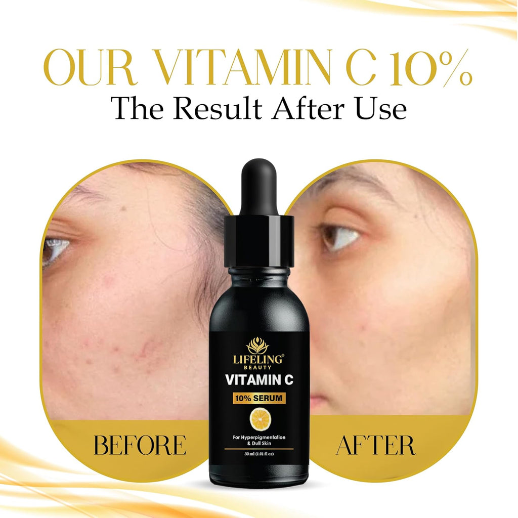 LIFELING BEAUTY Vitamin C 10% Serum for Hyperpigmentation & Dull Skin, Boosts Collagen Production, Brightens Skin, Fades Dark Spots, 30ml