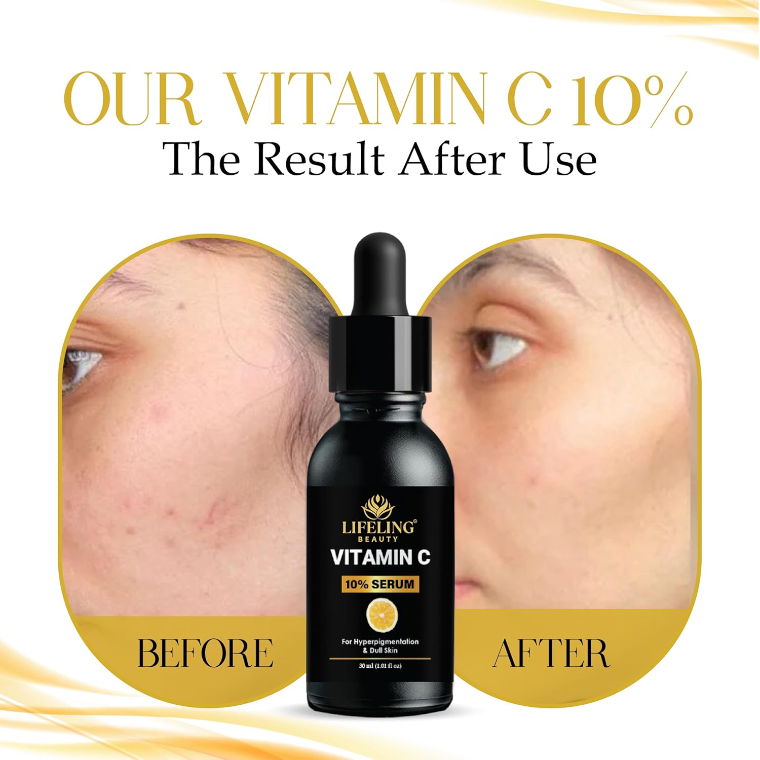 LIFELING BEAUTY Vitamin C 10% Serum for Hyperpigmentation & Dull Skin, Boosts Collagen Production, Brightens Skin, Fades Dark Spots, 30ml