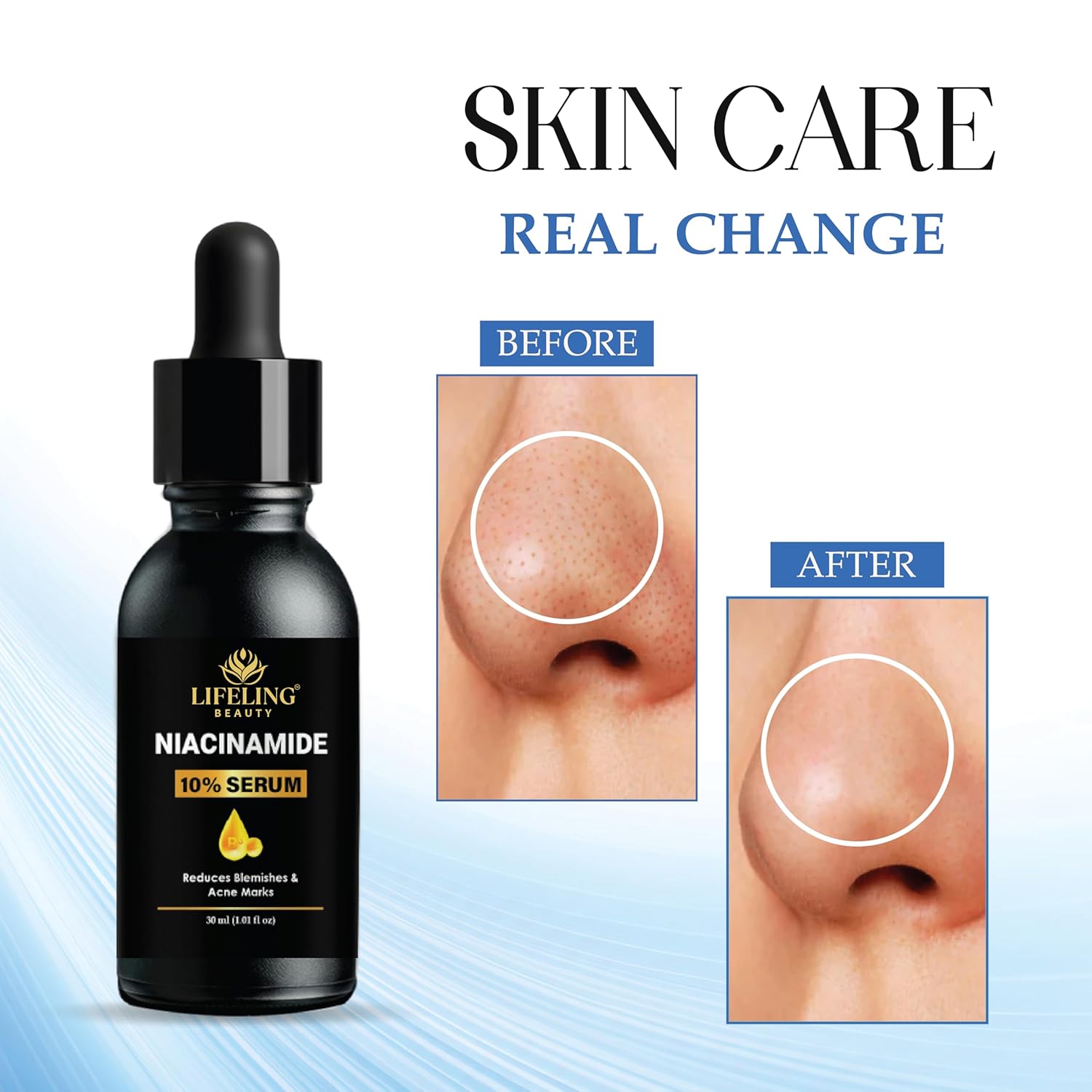 LIFELING BEAUTY Niacinamide 10% Face Serum, Reduces Blemishes & Acne Marks, Minimises Pores, 30ml