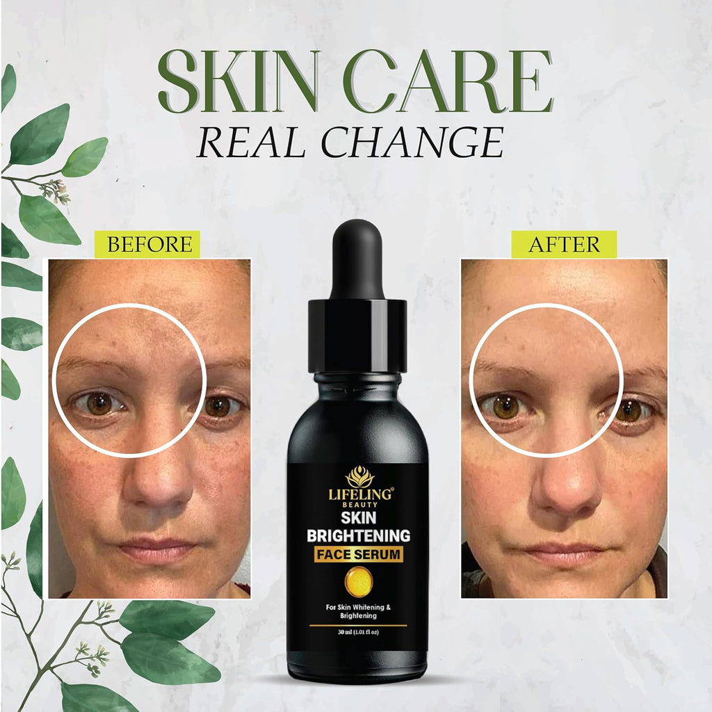 LIFELING BEAUTY Skin Brightening Face Serum with Niacinamide 10% and Hyaluronic Acid, Dark Spot Corrector, 30ml