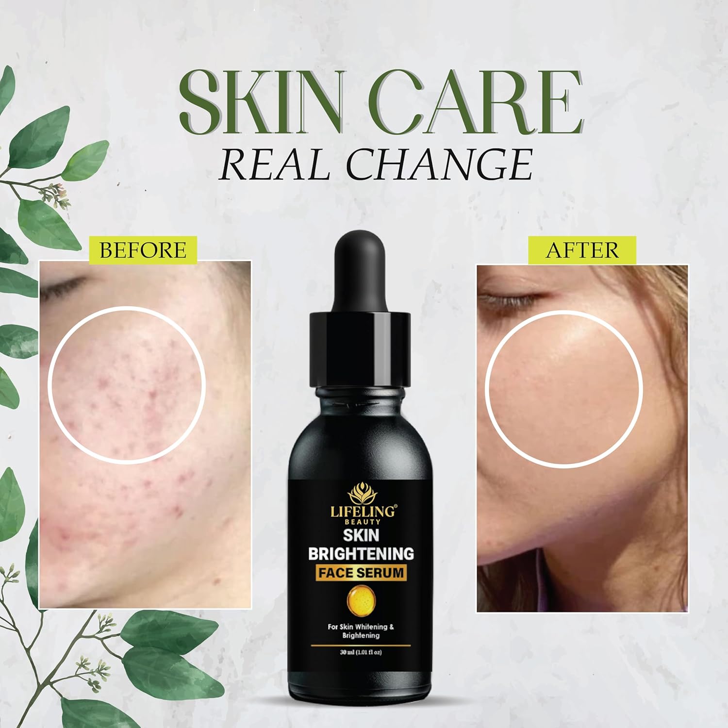 LIFELING BEAUTY Skin Brightening Face Serum with Niacinamide 10% and Hyaluronic Acid, Dark Spot Corrector, 30ml