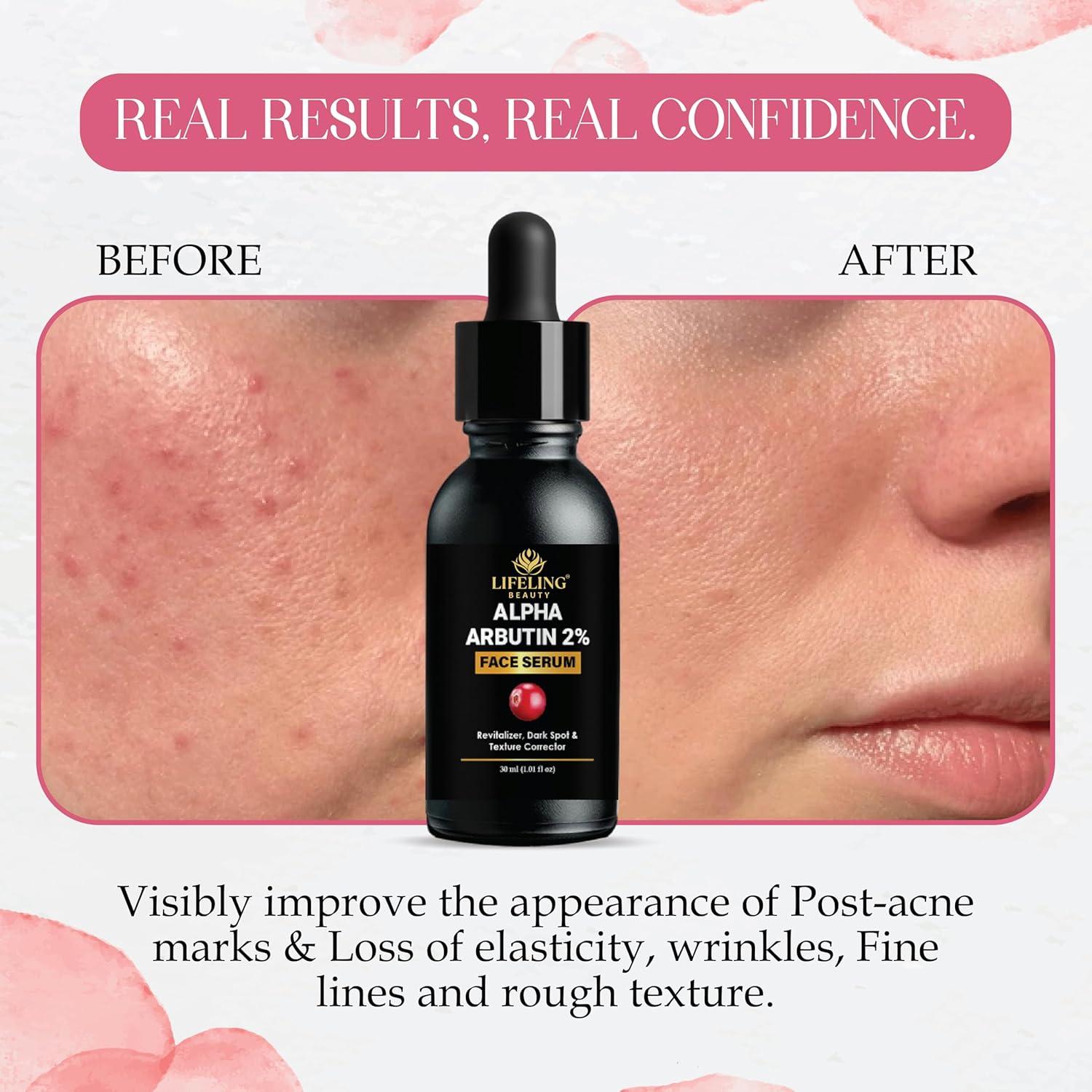 Lifeling Beauty Alpha Arbutin 2% Face Serum with Hyaluronic Acid, Dark Spot & Texture Corrector, 30ml